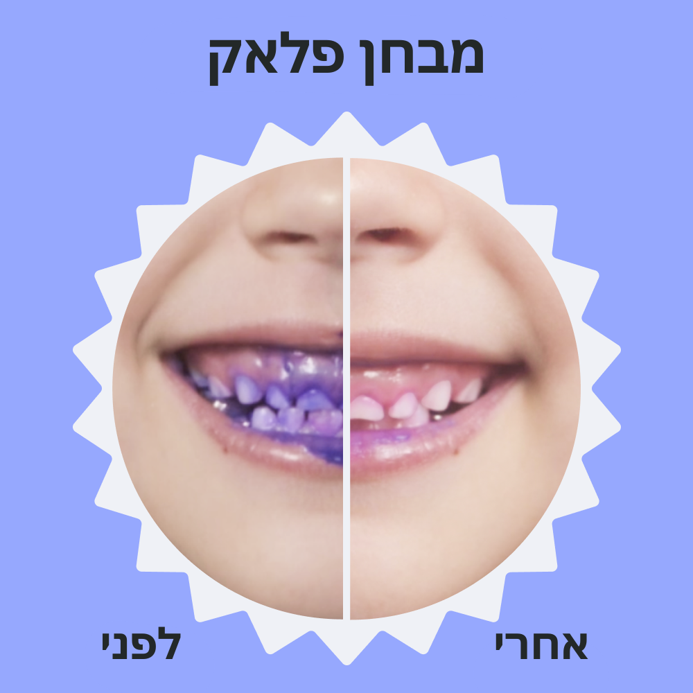 ™BRUSHY – מצחצחים, מחייכים, נהנים!